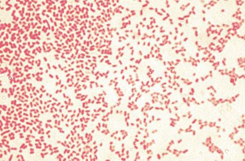 stain of gram negative bacteria